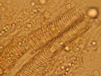 Xylem cells of elephant yam